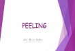 PEELING - Capacitate